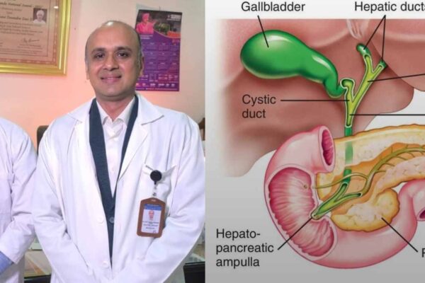 श्री महंत इन्दिरेश अस्पताल ने विश्व कैंसर दिवस पर चिकित्सा जगत में रचा इतिहास